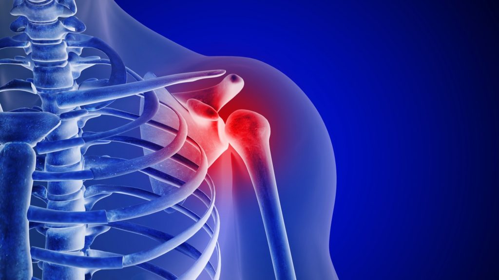 Shoulder pain